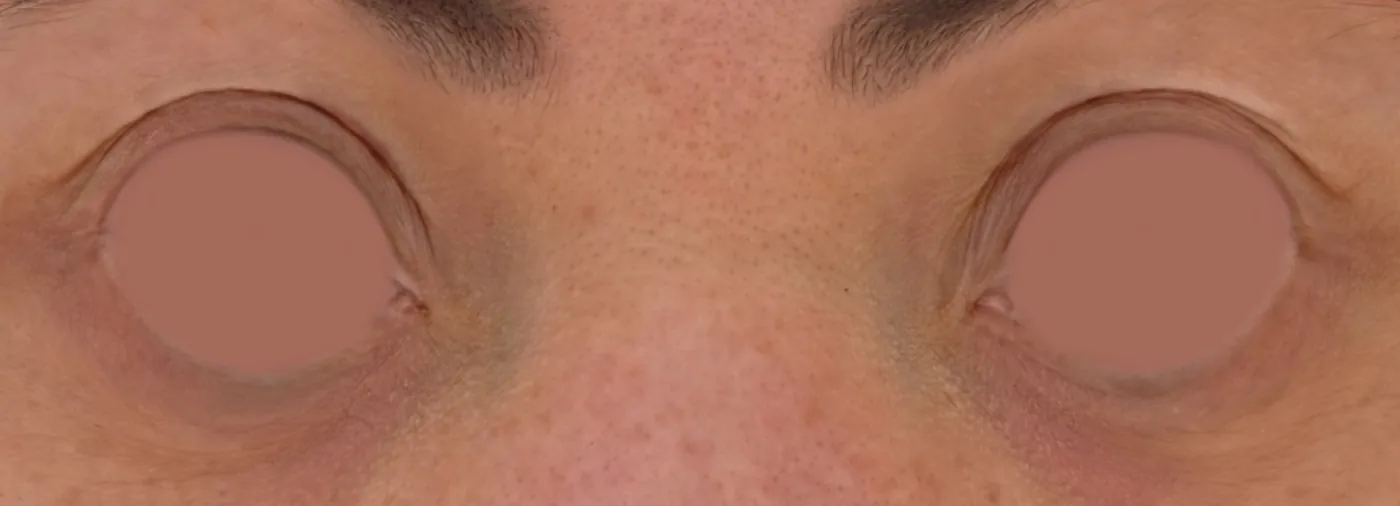 Close-up of the texture showing blank eye sockets